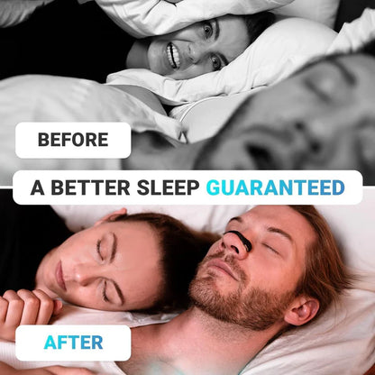 Magnetic nasal strips anti snoring nose clips skin safe starter (15 kit )